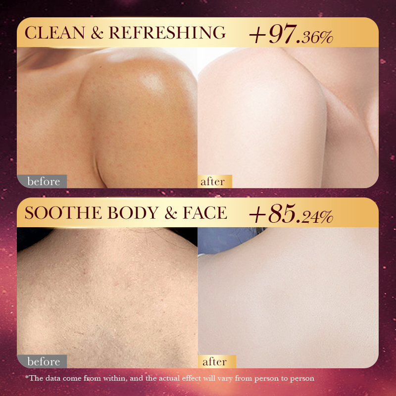 Rose Gold Foil Handmade Soap – - Luxury Rose Skincare 评论和价格